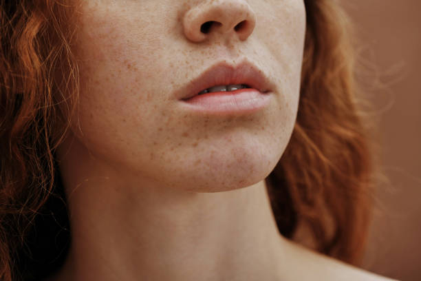 istock Young female face with freckles 1390873826