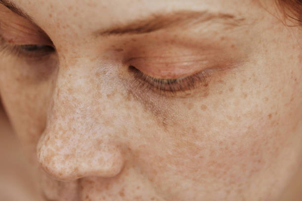 istock Female face with freckles 1390873829