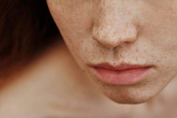 istock Young woman with freckles face 1390874044