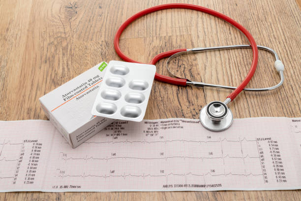 Heart trace ECG with a box of generic statin pills A heart trace ECG with a generic box of Statin pills and a stethoscope statin stock pictures, royalty-free photos & images