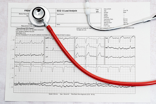 An abnormal ECG trace graph showing heart blocks with a stethoscope