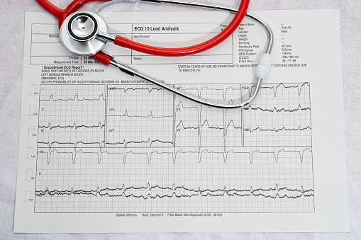 Photo of an EKG and a Heart