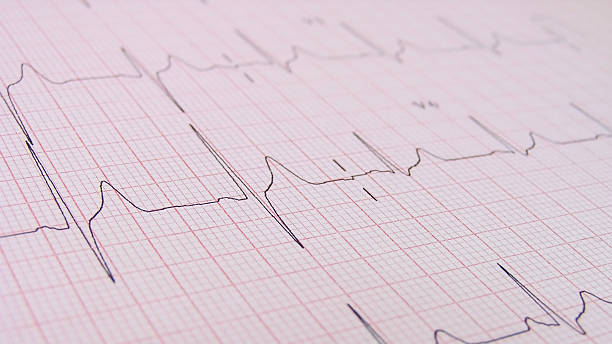 herzschlag/pulse von ecg - operation grafiken stock-fotos und bilder