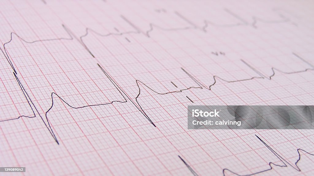 heart beat/pulso de ECG - Foto de stock de Latido cardíaco libre de derechos