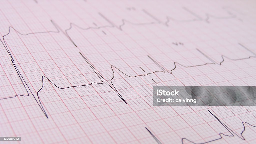 Battito cardiaco/polso da ECG - Foto stock royalty-free di Elettrocardiogramma