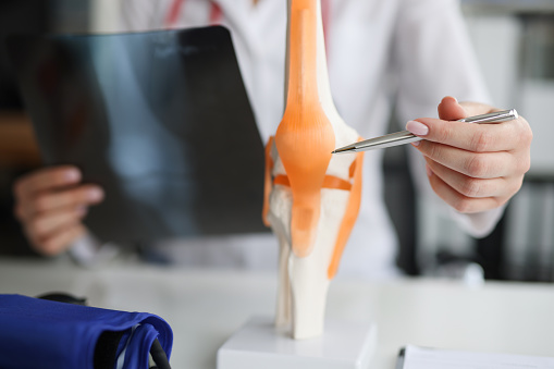 Médico traumatólogo examina la radiografía y las piernas y el modelo de la articulación de la rodilla photo