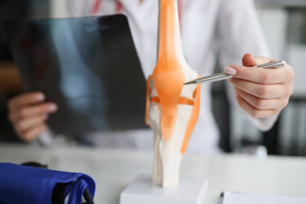 médico traumatologista examina raio-x e pernas e o modelo de articulação do joelho - radiogram photographic image - fotografias e filmes do acervo
