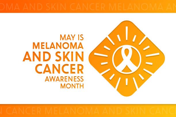 May is Melanoma and Skin Cancer Awareness Month. Vector illustration. Holiday poster. May is Melanoma and Skin Cancer Awareness Month. Vector illustration. Holiday poster melanoma stock illustrations