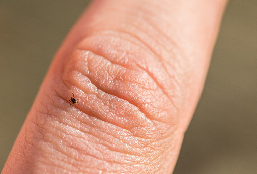 Tick Crawling on Human Finger.