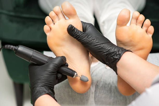 pelar los pies femeninos. manos de podología especialista en guantes negros utilizando equipos especiales de molienda pulir el pie femenino del callo y el maíz en el salón de belleza. - podiatrist customer service beauty spa fotografías e imágenes de stock