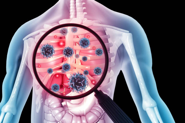 istock Virus or bacteria infecting respiratory system. 3d illustration 1391424911