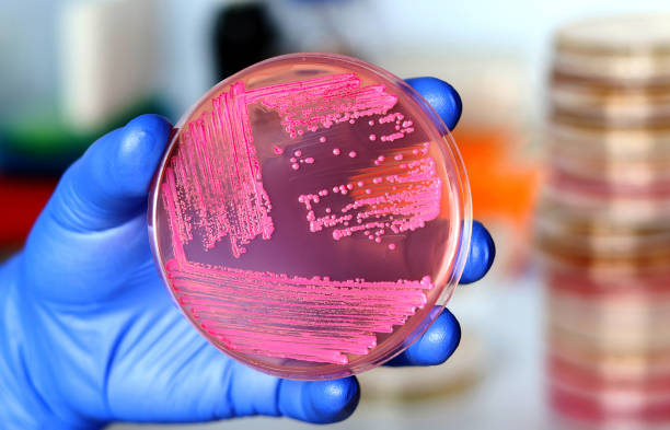 hand of a researcher showing a close-up of a microbiological culture plate with yeast - bacterial mat stockfoto's en -beelden
