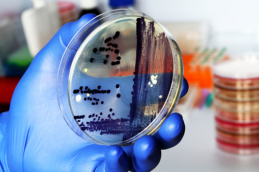 Colonias de bacterias púrpuras cultivadas en placa de Petri, vista de cerca. Antecedentes de bacteriología photo