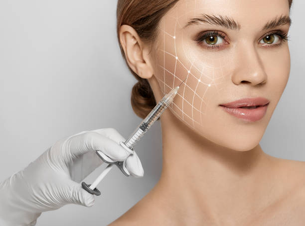 Beauty injections. Lifting lines on a woman's face showing of skin tightening and face contour correction with beauty injections in cosmetology stock photo