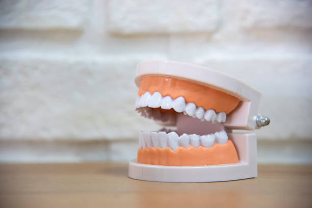 istock Model of teeth and gums.Dental concept 1391708950