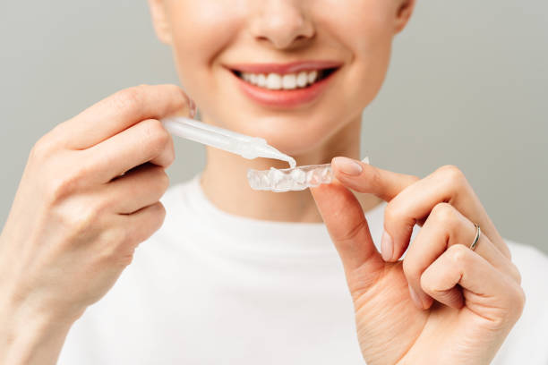 una mujer joven realiza un procedimiento de blanqueamiento dental casero. bandeja blanqueadora con gel - blanqueamiento dental fotografías e imágenes de stock
