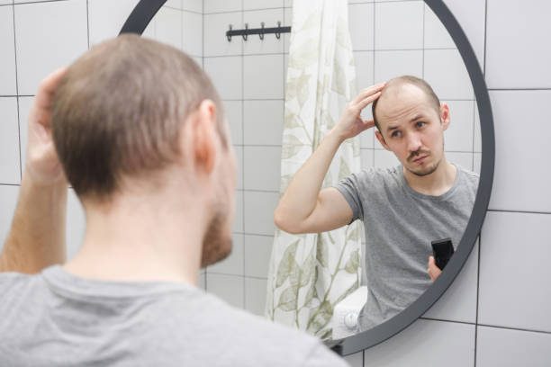 проблема выпадения волос. мужчина критически смотрит в зеркало в ванной, держащий в руках шинорез. - hairless стоковые фото и изображения