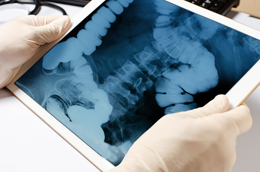 Imagen de rayos X del intestino en la tableta. Gadget en manos del médico de cerca. El concepto de telemedicina y diagnóstico de enfermedades photo