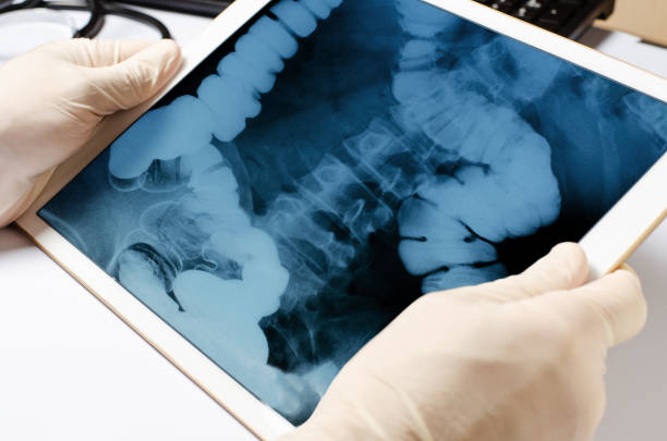 X-ray image of the intestine in the tablet. Gadget in the hands of the doctor close-up. The concept of telemedicine and diagnosis of diseases X-ray image of the intestine in the tablet. Gadget in the hands of the doctor close-up. The concept of telemedicine and diagnosis of diseases. rectum stock pictures, royalty-free photos & images