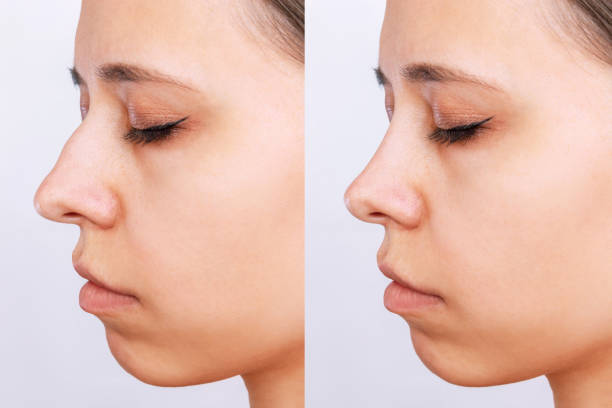 2,100+ Woman Nose Profile Stock Photos, Pictures & Royalty-Free Images -  iStock