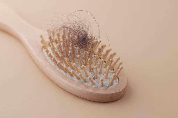 istock a brush with lost hair on table 1391948541