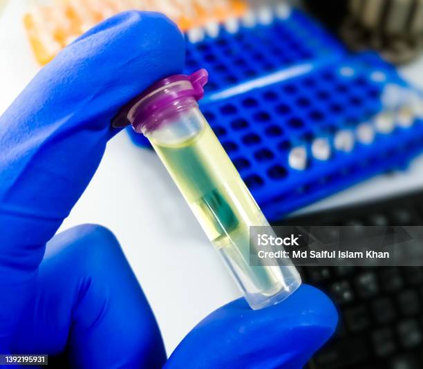 Eppendorf Tube With Cerebrospinal Fluid Sample For Pathological Study Including Biochemistry Cytology Gram Staining Stock Photo - Download Image Now