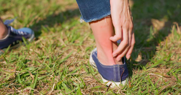 girl scratching her leg close up of legs - girl is scratching herself and bleeding bug bite photos stock pictures, royalty-free photos & images
