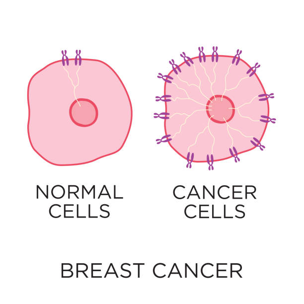 ilustraciones, imágenes clip art, dibujos animados e iconos de stock de células normales de cáncer de mama versus células cancerosas comparación ilustración vectorial de estilo plano en diseño de círculo con tipo, infografía médica - breast cancer awareness