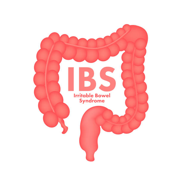 istock Irritable bowel syndrome IBS signs. Health messages about IBS diagnosis. Vector stock illustration. 1392498557