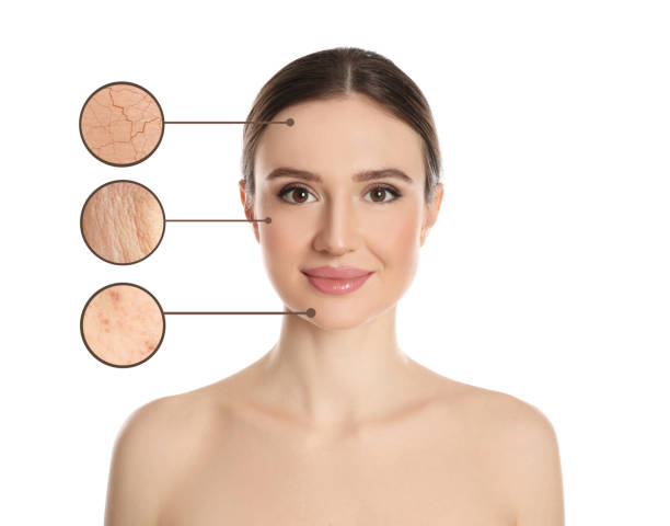 istock Young woman with skin problem on white background 1392510782