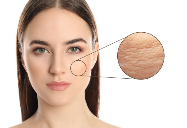 istock Young woman with skin problem on white background 1392511065