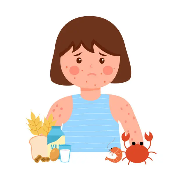 Vector illustration of Girl kids having food allergy symptom to products like seafood, gluten, egg, peanut and milk in flat design. Child got red spots on her skin.