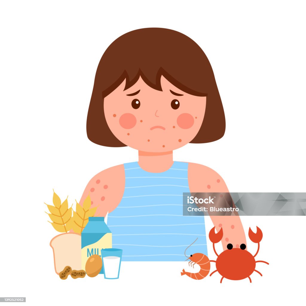 Trẻ Em Gái Có Triệu Chứng Dị Ứng Thực Phẩm Với Các Sản Phẩm Như ...