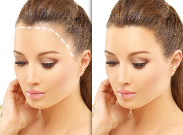 Thyroid Hair Loss Stock Photos, Pictures & Royalty-Free Images - iStock Thyroid Hair Loss Stock Photos, Pictures & Royalty-Free Images - iStock