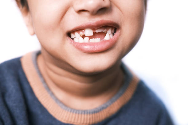 child with a tooth dropped out.