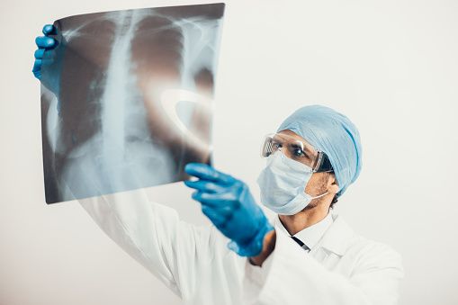 close up. doctor looking at the x-ray of the lungs. photo with a copy-space.