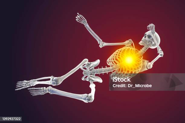 Human Skeleton In A Bad Feeling Unconsciousness Position Conceptual 3d Illustration Stock Photo - Download Image Now
