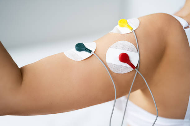 elektrodenarmstimulation und -training. schmerztherapie - electrode healthcare and medicine medicine health care stock-fotos und bilder