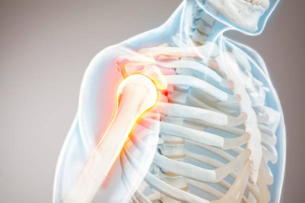 istock Shoulder bone and trapezius pain. Man view from side, arm pain. 1393105378