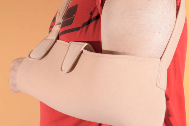 istock Man with his left arm in a sling after an operation to place a screw for a broken humerus. 1393183039