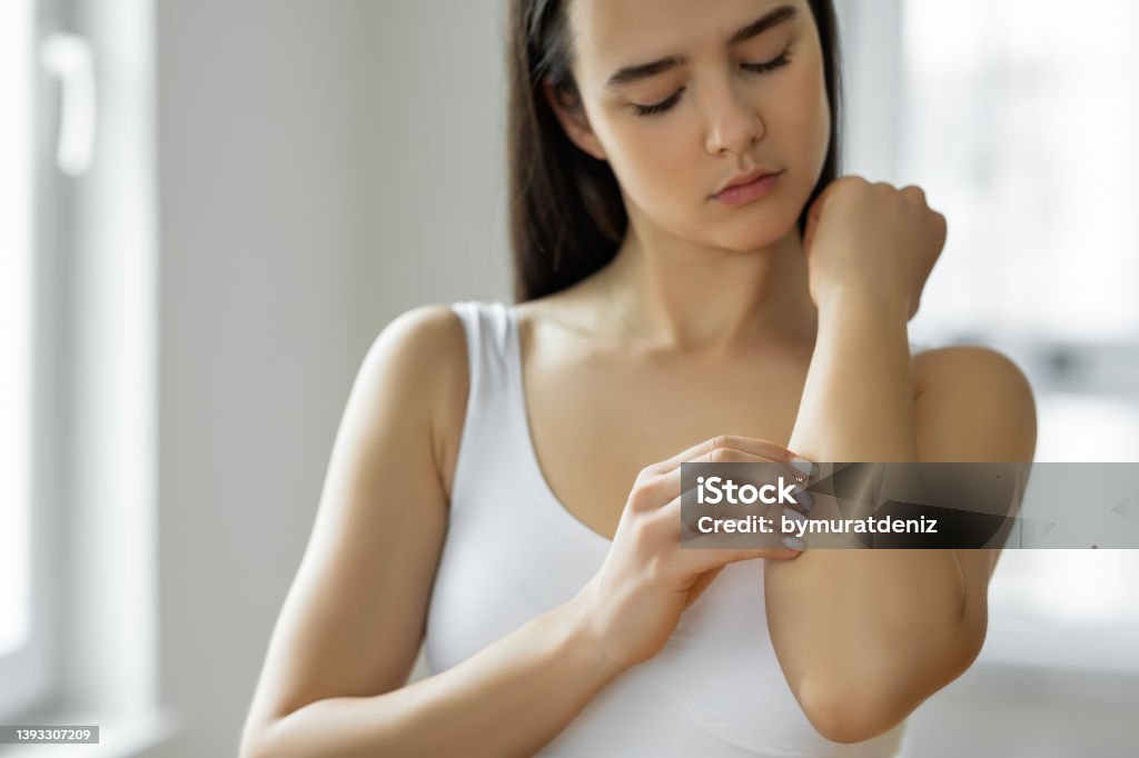 Young woman scratching her arm Psoriasis Stock Photo