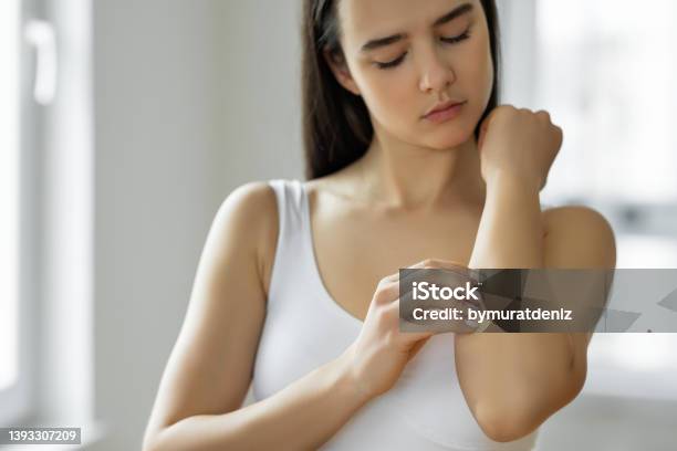 Young Woman Scratching Her Arm Stock Photo - Download Image Now - Psoriasis, Scratching, Arm