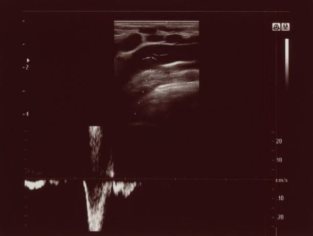 istock ultrasonic diagnostic sonography 1393372328