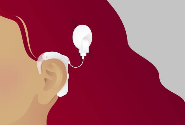 светлокожая женщина с белым кохлеарным имплантом для снижения слуха - ear canal stock illustrations