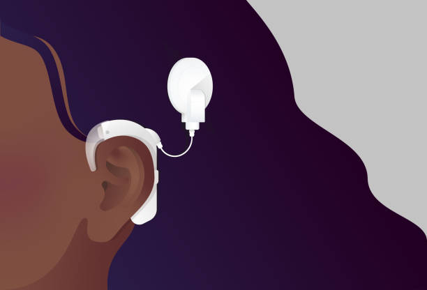 Dark-skinned woman with white cochlear implant to aid hearing loss Colored editable and scaleable vector illustration of.a cochlear implant to illustrate discussions on the Deaf community, deafness, hearing loss, disability aids, medical technology, audism and other topics relating to auditory health. ear canal stock illustrations