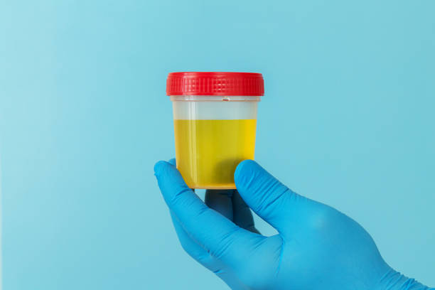 образец мочи для лабораторного анализа на инфекцию мочевыводящих путей - doping test стоковые фото и изображения