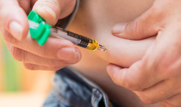 gros plan d’une injection sous-cutanée avec une seringue dans la paroi abdominale - insulin diabetes pen injecting photos et images de collection