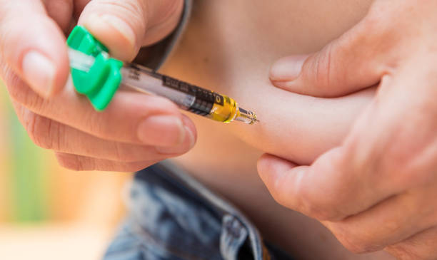 close-up of a subcutaneous injection with a syringe into the abdominal wall - insulin diabetes pen injecting imagens e fotografias de stock