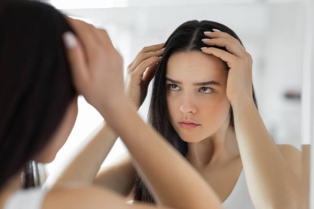 donna che ha problemi con la caduta dei capelli - capelli o peli foto e immagini stock