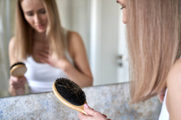Shocked caucasian woman holding hairbrush with many hair on it stock photo